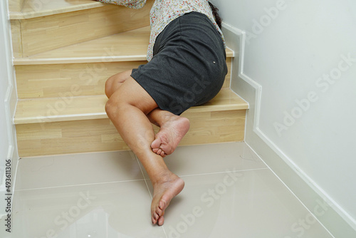 Asian lady woman injuries from falling down on slippery surfaces stairs at home.