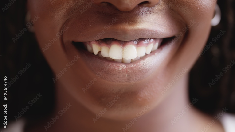 Fototapeta premium Beautiful african woman smiling, healthy teeth, dental care, whitening system