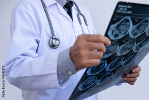 Doctor examining patient's knee joint x-ray films, MRI bone, CT scan in at radiology orthopedic unit in hospital. Knee joint film x ray