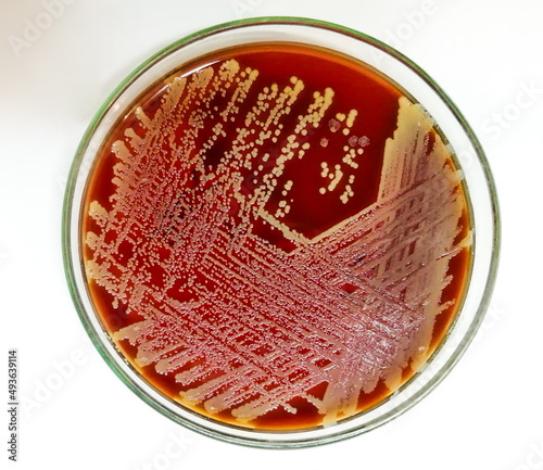 Staph aureus: Gram positive bacteria. Staphylococcus or streptococcus growth on blood agar. photo