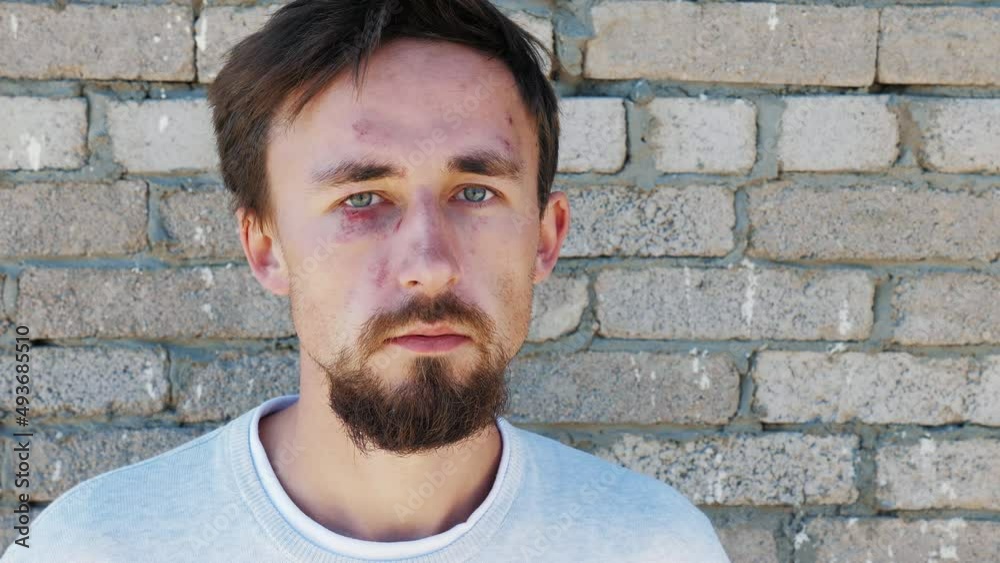 Portrait of european sad man with bruises and cuts on his face. Beaten citizen injured in fight stand near brick wall. Male victim of revenge, banditry, crime. Guy who showed heroism and courage Portrait of european sad man with bruises and cuts on his face. Beaten citizen injured in fight stand near brick wall. Male victim of revenge, banditry, crime. Guy who showed heroism and courage