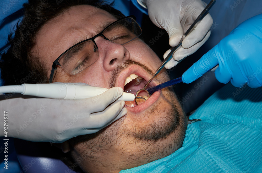 A man with a slight beard undergoing a dental procedure A man with a slight beard undergoing a dental procedure