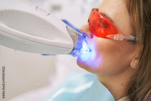 Woman having laser teeth whitening procedure in stomatology clinic photo