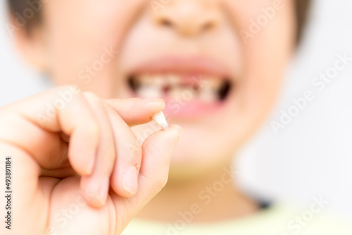子供　生えかわり　乳歯