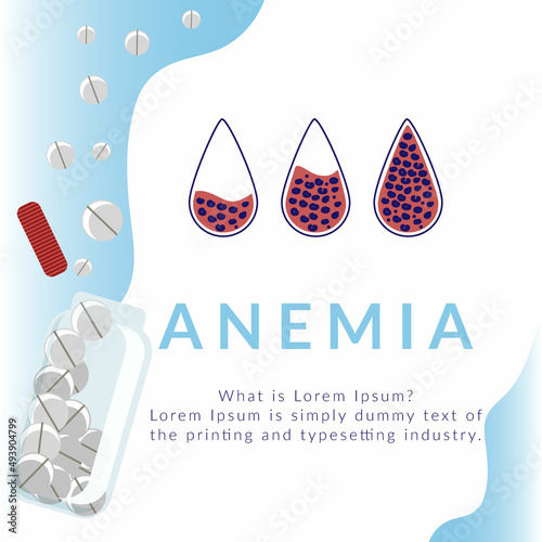 A concept on the topic of anemia. The difference Anemia number of red blood cells and normal. Illustration about medicine. Flat style vector.