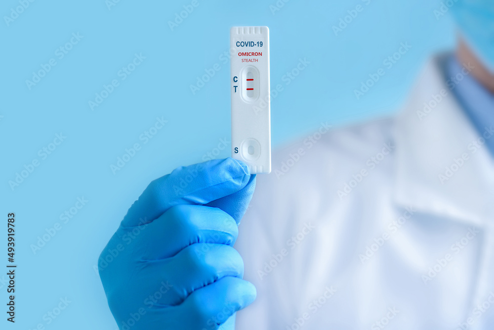 A doctor wearing a protective mask and gloves shows a rapid laboratory test for COVID-19 Omicron Stealth variant strain to detect IgM and IgG antibodies to the new coronavirus. Positive result A doctor wearing a protective mask and gloves shows a rapid laboratory test for COVID-19 Omicron Stealth variant strain to detect IgM and IgG antibodies to the new coronavirus. Positive result