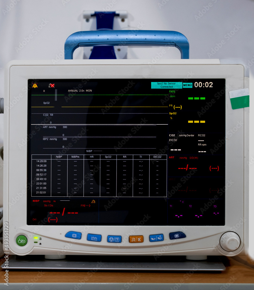 monitor in the hospital where the vital functions of the patient are followed. 