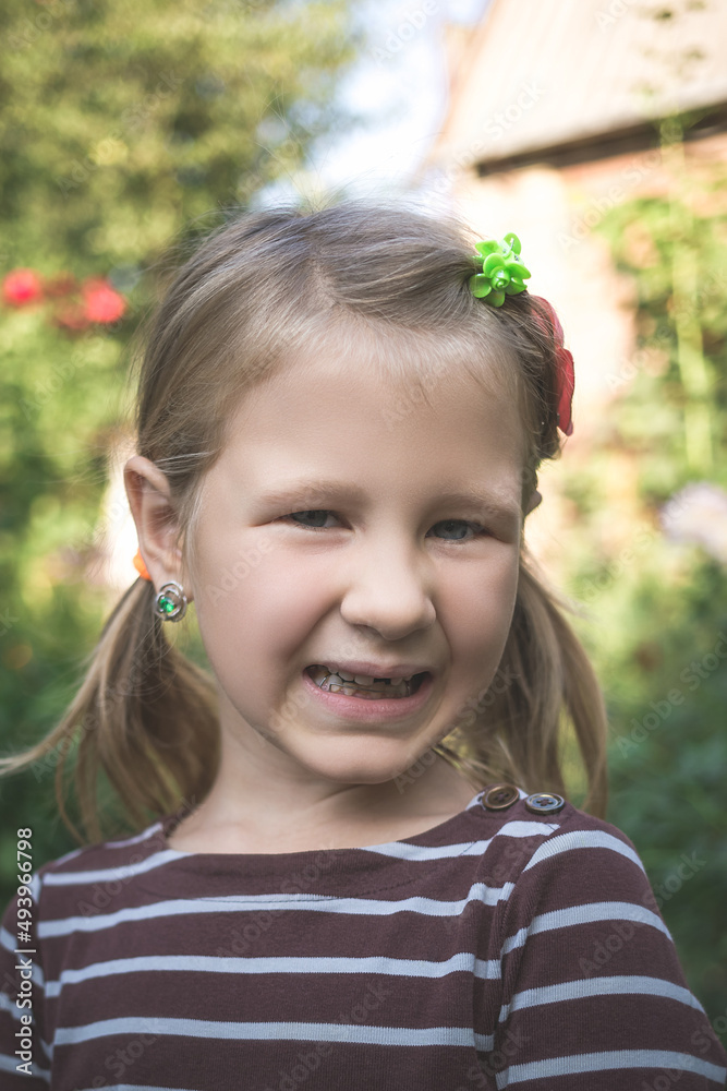 Child with a dental orthodontic device and without one tooth Child with a dental orthodontic device and without one tooth