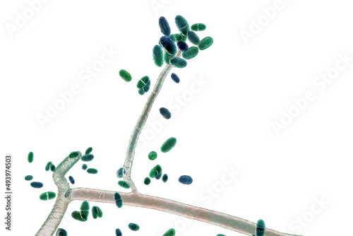Mold fungi Acremonium, illustration photo
