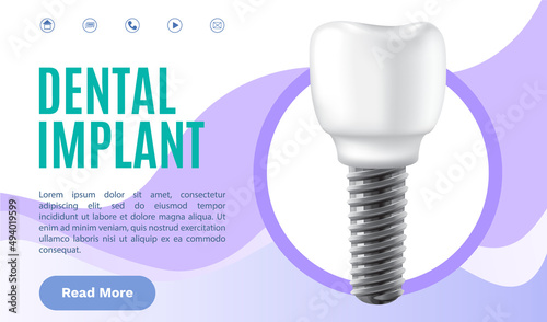 Dental clinic poster vector illustration. Advertising of hospital for teeth treatment. Medical services for installation of dental implant. Human gum with healthy teeth and denture on dentistry banner