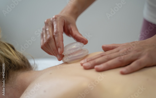 Fotografi Massage cupping therapy