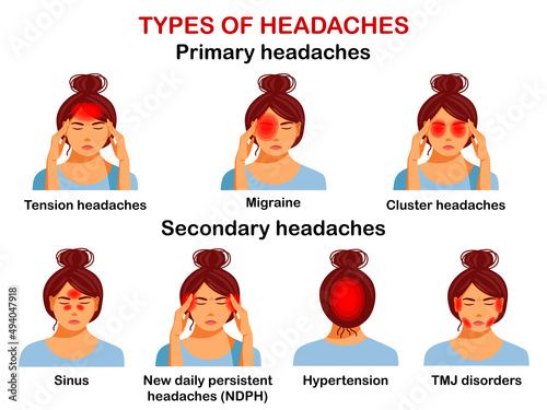 Types of headaches. Vector Infographic.
