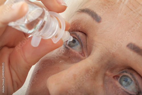 Senior woman drips eye drops into her eyes. Woman suffering from irritated eyes or eye diseases. Vision and ophthalmology medicine.