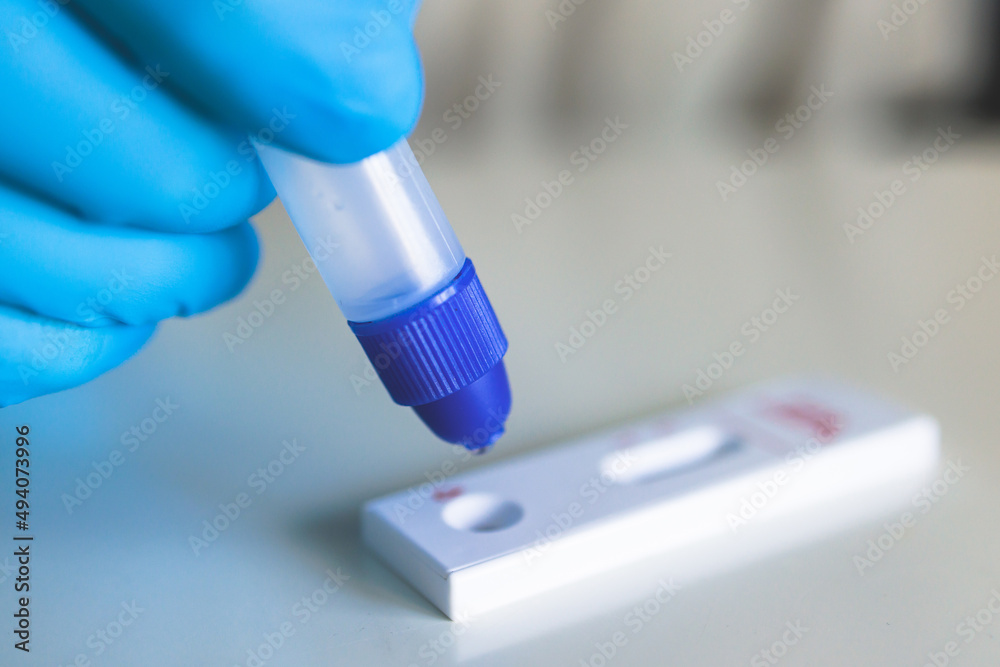 Process of express fast coronavirus covid Antigen AG PCR testing examination at home, COVID-19 swab collection kit, test tube for taking OP NP patient specimen sample, testing carried out