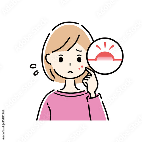 女性　ニキビ　吹き出物