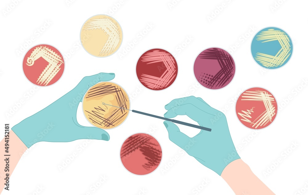 Agar plate method cell colony growth loop Bacteria Test blood stool