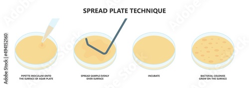 Agar plate method cell colony growth loop Bacteria Test blood stool urine mucus spinal fluid Sepsis Lab microbe fungi virus exam throat strep petri dish pour c diff germs Inoculate bacteriological