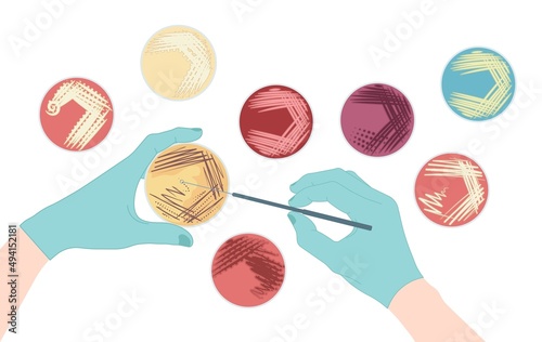 Agar plate method cell colony growth loop Bacteria Test blood stool urine mucus spinal fluid Sepsis Lab microbe fungi virus exam throat strep petri dish pour c diff germs Inoculate bacteriological