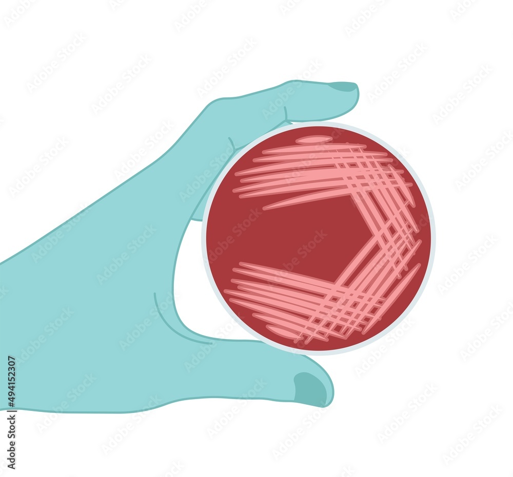 Plakat Agar plate method cell colony growth loop Bacteria Test blood