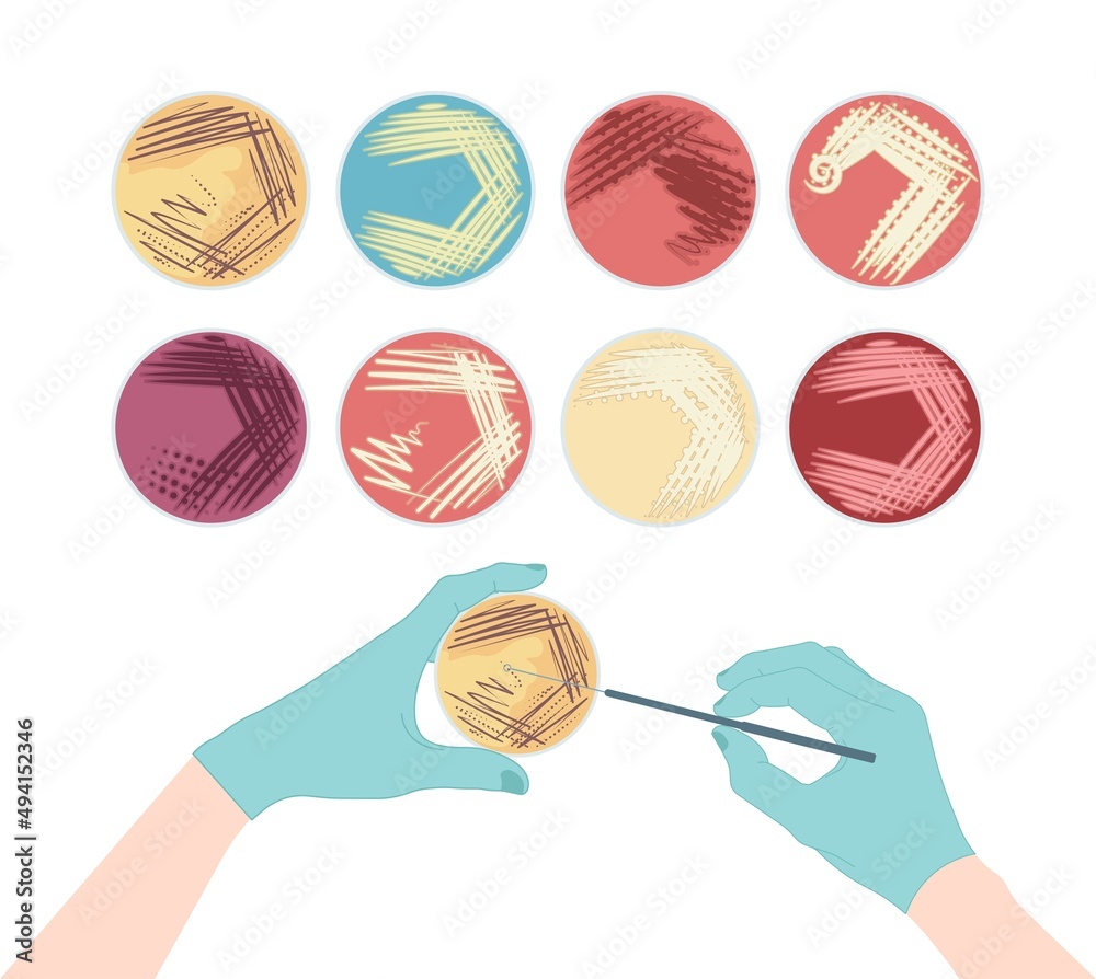 Agar plate method cell colony growth loop Bacteria Test blood stool