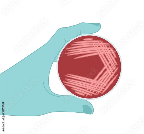 Agar plate method cell colony growth loop Bacteria Test blood stool urine mucus spinal fluid Sepsis Lab microbe fungi virus exam throat strep petri dish pour c diff germs Inoculate bacteriological