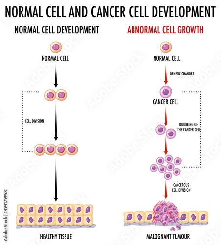 Diagram showing normal cell and cancer cell
