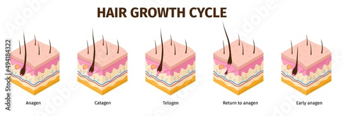 Isometric hair follicle growth cycle steps infographic. Skin anatomy medical poster. Hair grow anagen, telogen, catagen phases vector set