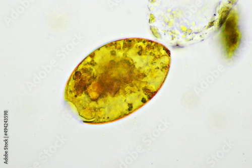 Billede på lærred Egg of intestinal fluke in human stool, analyze by microscope, original magnific