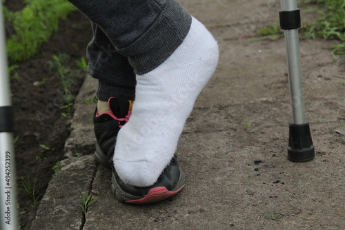 bandaged leg in plaster. a girl with a broken finger leg. health people with disabilities © Кристина Шоба