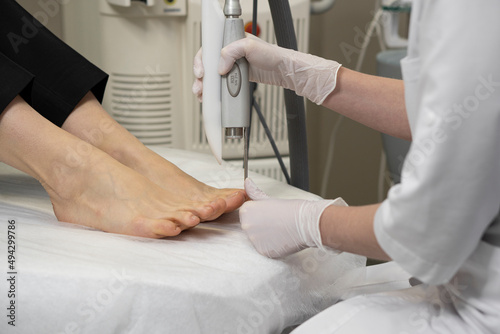 The doctor makes the procedure for the treatment of foot fungus. A patient receiving laser therapy for a toenail. Fungal infection on the nails. Treatment of onychomycosis with a medical laser © Tetiana