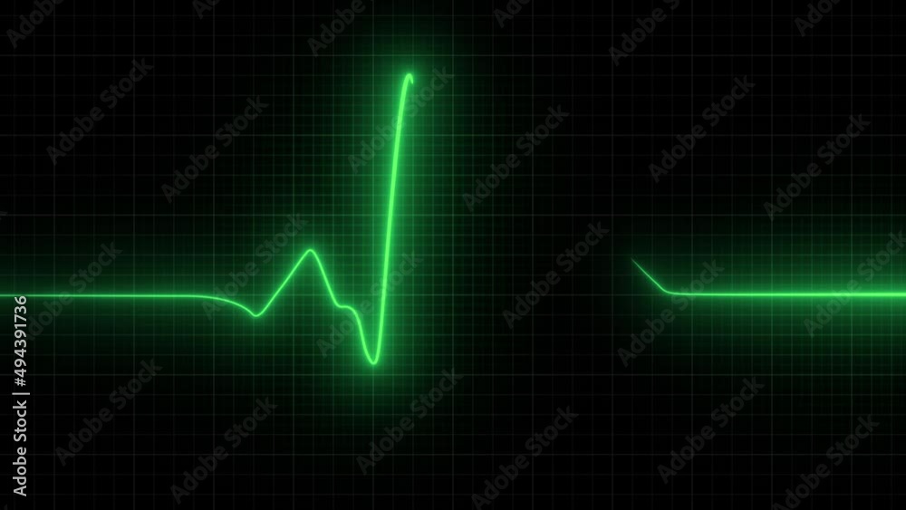 EKG. heart rate monitor. Heart beat pulse in green - cardiology. Looped animation
