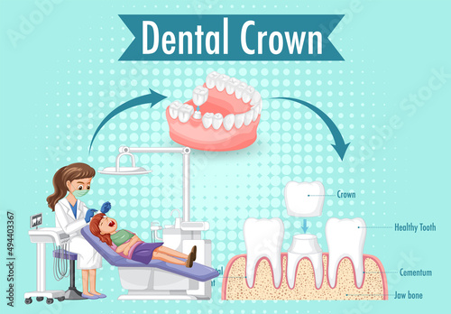 Infographic of human in dental crown