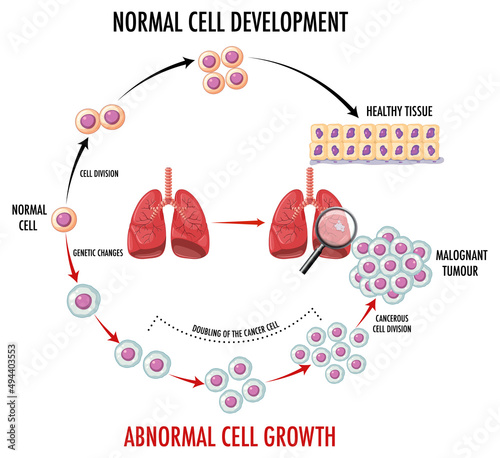 Diagram showing cancer development process