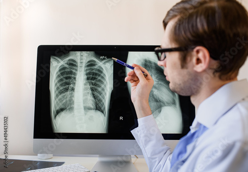 Radiologist analyzing a chest x-ray with pneumonia in right hemithorax lung. photo