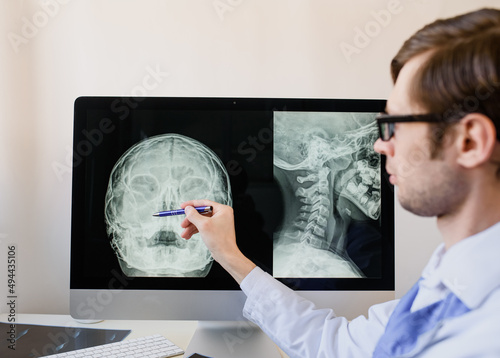 radiologist analyzing a paranasal sinus x-ray with maxillary sinusitis of a otorhinolaryngologist patient.. photo