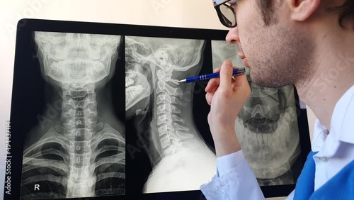 Doctor radiologist analysing a cervical spine x-ray of a patient with spinal chronic pain.