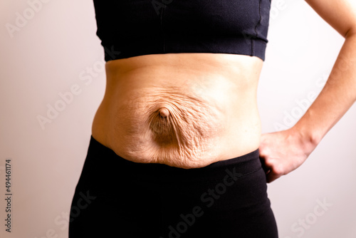 cropped woman dressed in black top and black leggings. Diastasis and umbilical hernia after pregnancy photo