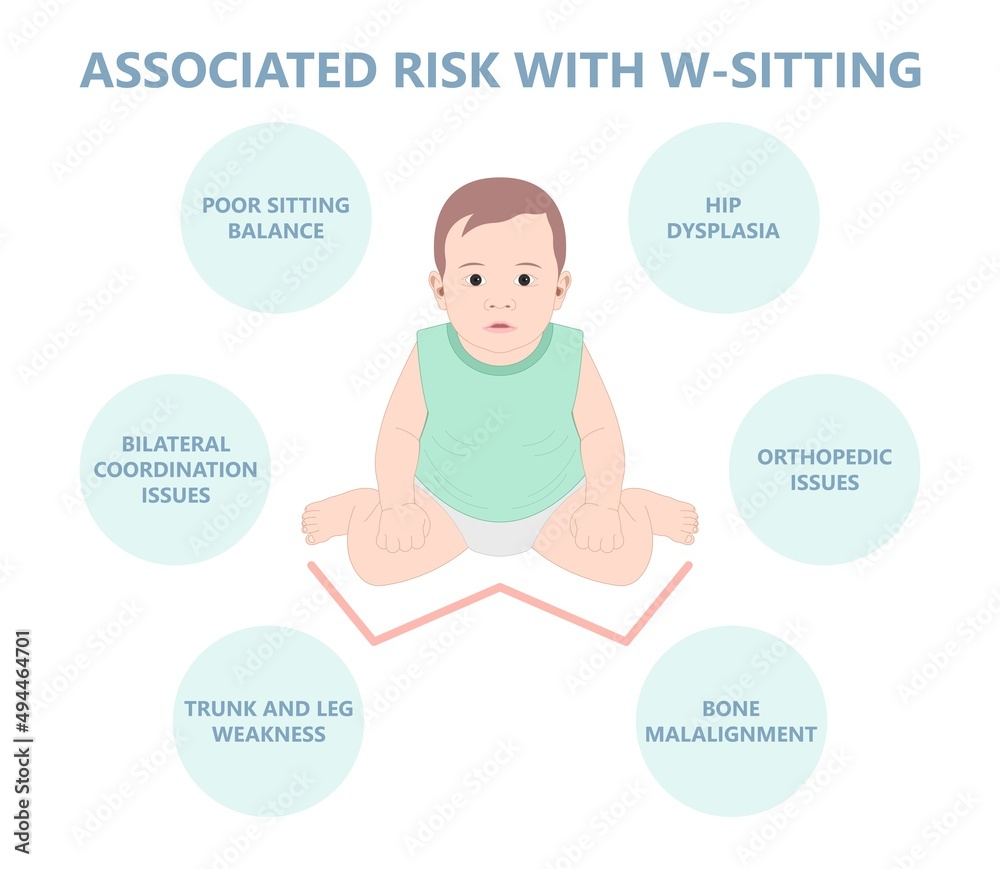 Birth infant genu valgum varum criss cross and club foot tailor body