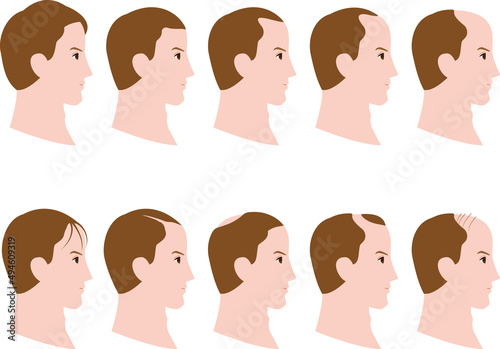 横顔の男性の毛量の増減するイラスト