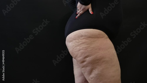 fat woman with cellulite on her legs on a black background photo