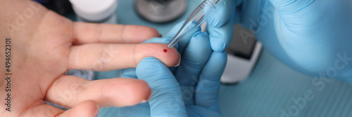 Doctor taking blood test from patient finger with pipette in laboratory closeup