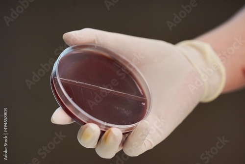 A hand holding a petri dish with a dark red agar medium, showcasing a microbiological sample. photo