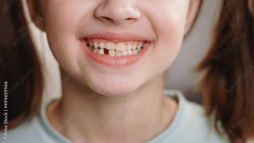 Close up portrait of young caucasian little girl smiling with a toothless smile. Loss of milk teeth, replacement of permanent teeth. Children is dentistry. Show no teeth. Remove the milk tooth. Close up portrait of young caucasian little girl smiling with a toothless smile. Loss of milk teeth, replacement of permanent teeth. Children is dentistry. Show no teeth. Remove the milk tooth.