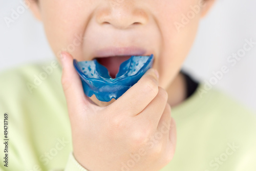 日本人の子供の歯列矯正の写真