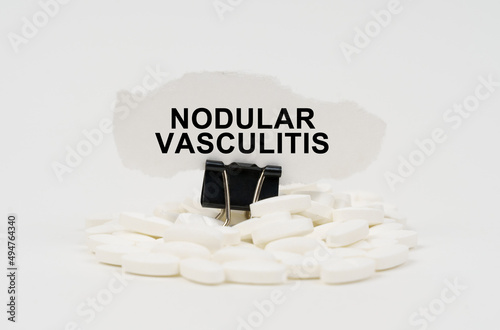 On a white surface are pills and torn paper with the inscription - Nodular vasculitis photo