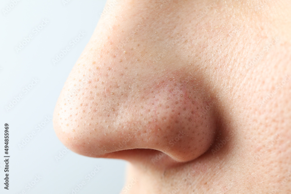 Concept of skin care with nose with dots Concept of skin care with nose with dots