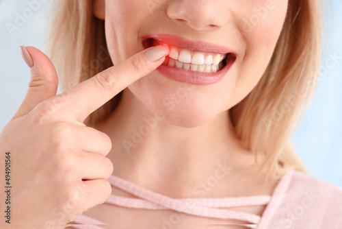 Young woman with gum inflammation on light background, closeup photo