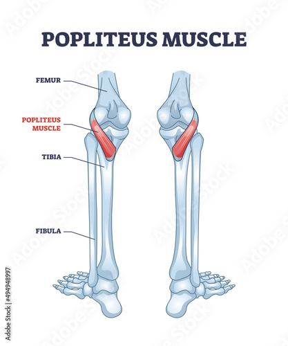Popliteus muscle as leg and knee muscular joint anatomy outline diagram. Labeled educational scheme with femur and tibia bones that is connected with popliteal muscular system vector illustration. photo
