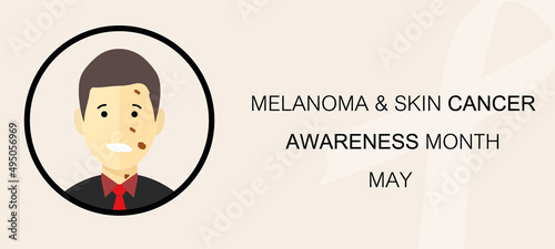 Poster or banner of Melanoma and skin cancer awareness day in May. Flat icon with melanoma patient.