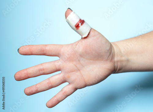 Oopen palm of a human hand and an injured bandaged thumb. 